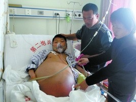 Chàng trai 20 tuổi bế 'bụng bầu' 13 năm Chàng trai 20 tuổi bế 'bụng bầu' 13 năm