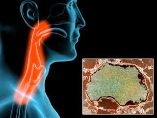Quan hệ bằng miệng dẫn tới ung thư họng Quan hệ bằng miệng dẫn tới ung thư họng