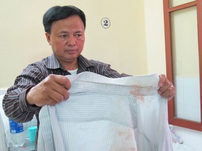 Giám đốc tố bị công an đánh chuyển viện Giám đốc tố bị công an đánh chuyển viện