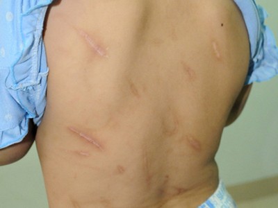 Bố dùng búa đinh đánh con gái 10 tuổi? Bố dùng búa đinh đánh con gái 10 tuổi?