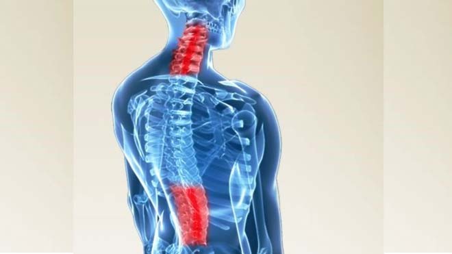 Những vị trí cột sống thường bị thoái hóa Thoái hóa cột sống thường gặp ở đốt sống cổ và thắt lưng.