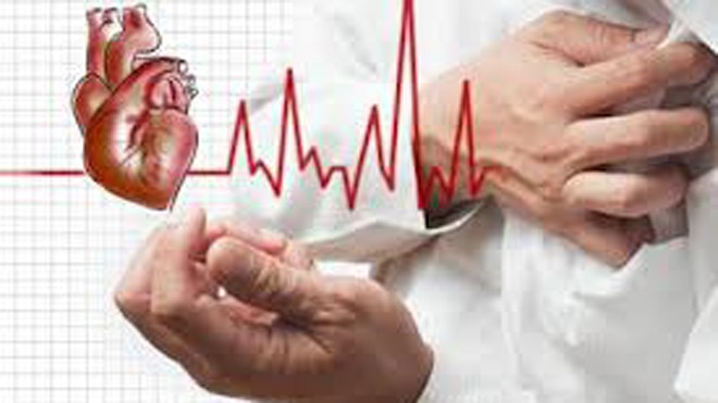 Thời gian vàng để cứu bệnh nhân nhồi máu cơ tim cấp Ảnh minh họa
