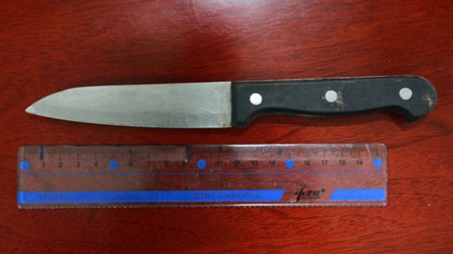 Sống sót kỳ diệu dù bị dao cắm ngập đỉnh đầu Toàn bộ lưỡi dao dài 11 cm cắm sâu vào đầu bà Liu sau cú ngã. Ảnh: Rex