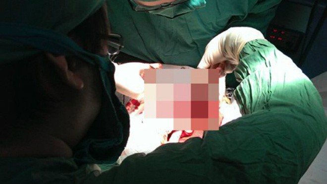 Quý ông mang họa vì những cách 'tự sướng' quái chiêu Nhiều quý ông đã có tuổi vẫn phải nhập viện vì nghịch dại. Ảnh: BVBD