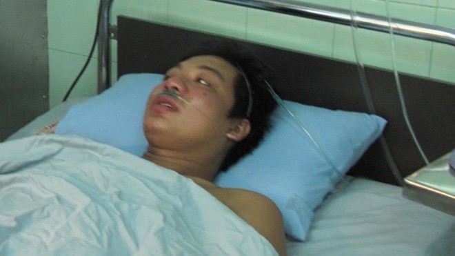 Sức khoẻ công nhân sống sót 'thần kỳ' đang phức tạp Sau vài giờ tỉnh táo nói chuyện, chiều 24/7 sức khoẻ bệnh nhân Mai Thanh Sang có diễn biến phức tạp.