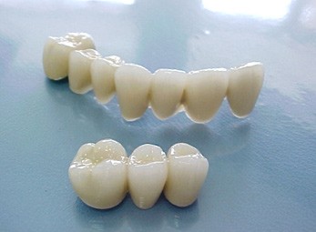 Suýt chết vì nuốt răng giả bị rơi khi đánh răng Ảnh minh họa
