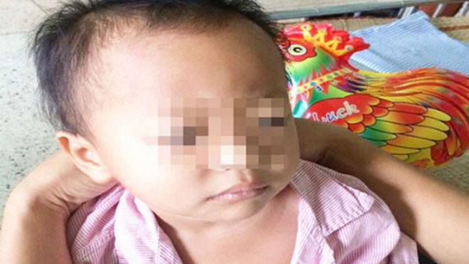 Cảnh giác khi trẻ đau bụng bất thường Bé Hoài đã bình phục sau ca mổ cấp cứu chữa biến chứng do nang ống mật chủ vỡ. Ảnh: Lê Mai.