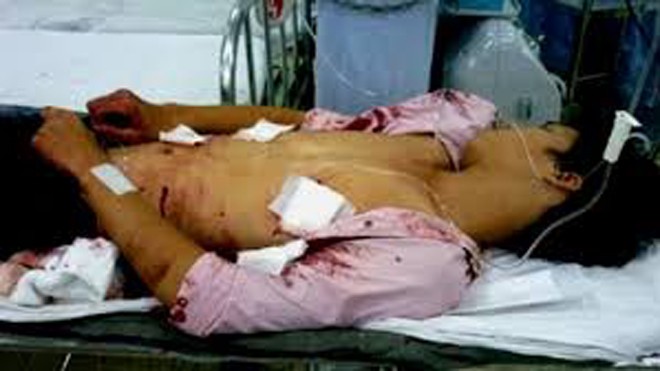 Mang họa sát thân vì tát cha dượng Mang họa sát thân vì tát cha dượng