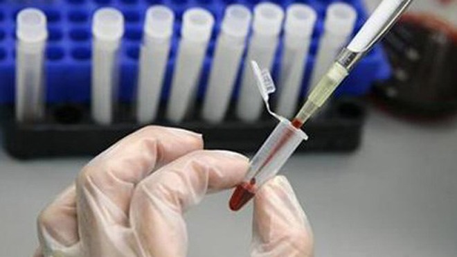 Nghi án, bác sĩ truyền HIV cho hơn 100 người Ảnh minh hoạ: Reuters