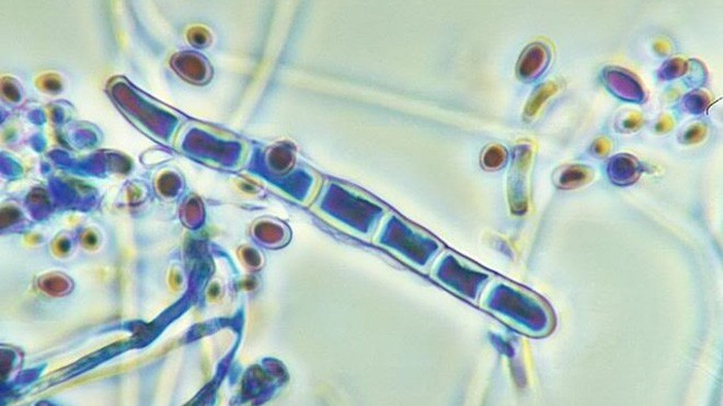 Hắc lào - Cần điều trị ngay, tránh lây lan Nấm trichophyton gây bệnh hắc lào.