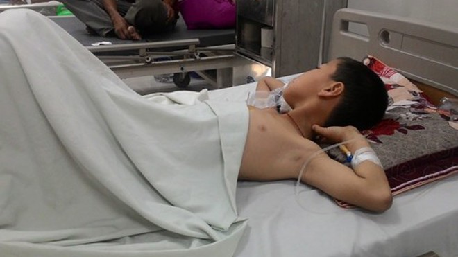 Hỏa khí phát nổ, bé trai bị đa chấn thương Trẻ hiện qua cơn nguy kịch.