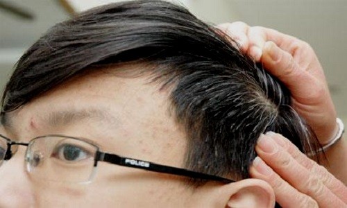 Ăn gì 'bổ' tóc Ảnh minh họa: News.