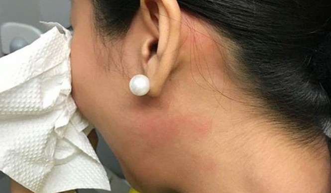 Khách VIP tát tiếp viên hàng không bị cấm bay Tiếp viên sau khi bị ông Bình tát