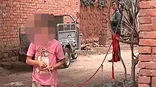 Bé gái tâm thần bị ông bà trói ở cây suốt 6 năm Zhao Ziyi bị trói ở cây vì "nguy hiểm" cho mọi người. Ảnh: Standard