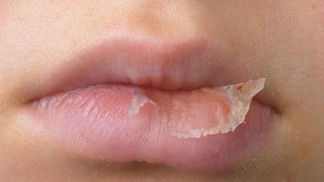 Thành phần có trong dưỡng môi khiến càng bôi càng khô Thành phần có trong dưỡng môi khiến càng bôi càng khô