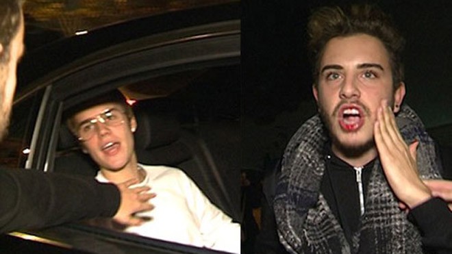 Ca sỹ Justin Bieber đấm người hâm mộ chảy máu miệng Justin Bieber đấm khi người hâm mộ chạm vào mình.