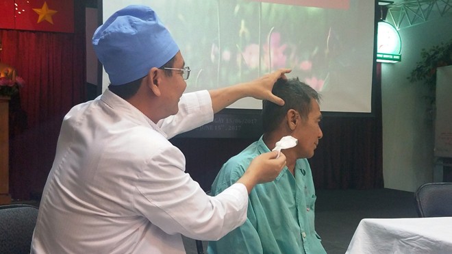 Tăm bông nằm trong tai hơn 1 năm, nhiều bệnh viện khám không ra Bệnh nhân bị gãy tăm bông trong tai hơn 1 năm.
