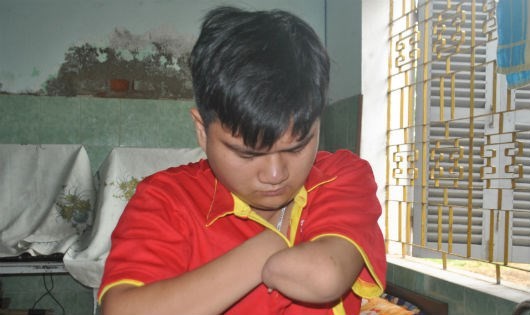 Cậu bé mồ côi, cụt tứ chi trở thành sinh viên đại học Cậu bé mồ côi, cụt tứ chi trở thành sinh viên đại học