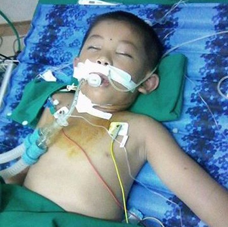 Bị đàn ong tấn công, cháu bé nhập viện trong tình trạng nguy kịch. Bị đàn ong tấn công, cháu bé nhập viện trong tình trạng nguy kịch.