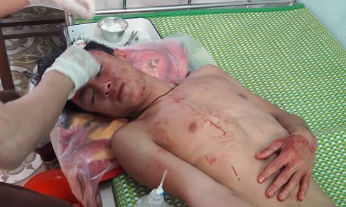 Đề nghị công an vào cuộc vụ hai thầy trò bị đánh nhập viện Học sinh Tài điều trị tại bệnh viện.