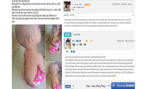Chữa bệnh kiểu ‘các mẹ ơi...’, con trẻ rước họa Phương pháp chữa sốt bằng lươn (trái) cho bé được một mẹ bỉm sữa chia sẻ và phương pháp chữa đau mắt bằng sữa mẹ (phải) được truyền tai, hậu quả là một phụ huynh làm theo khiến mắt bé bị nặng hơn. Ảnh: ITN
