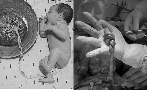 Bà bầu 18 tuổi ở Hà Nội sắp đẻ mà không biết Bà bầu 18 tuổi ở Hà Nội sắp đẻ mà không biết