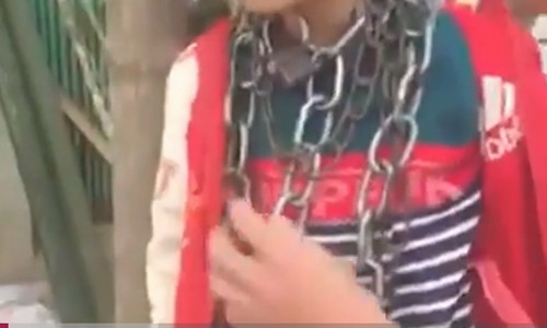 Người chú bị phạt cảnh cáo vì xích cổ cháu Người chú bị phạt cảnh cáo vì xích cổ cháu