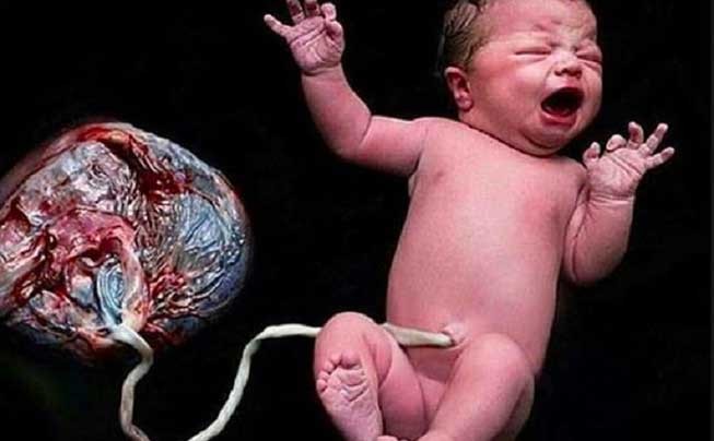 Hàng loạt bác sĩ lên án mạnh mẽ 'sinh thuận tự nhiên' Hàng loạt bác sĩ lên án mạnh mẽ 'sinh thuận tự nhiên'