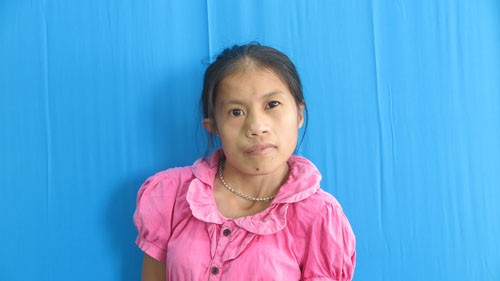 Phép màu xuất hiện sau 20 năm cuộc đời của cô gái trẻ Thái Nguyên Vi Thị Phú mắc dị tật xương hàm, khớp cổ lệch, vẹo cột sống và dị tật tai
