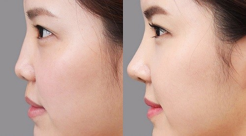 Lột xác 180 độ: Bạn có dám thử Lột xác 180 độ: Bạn có dám thử