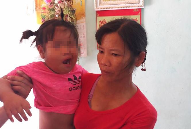 Vụ cô giáo bị tố đánh trẻ méo mồm: Không có dấu vết của thương tích? Vụ cô giáo bị tố đánh trẻ méo mồm: Không có dấu vết của thương tích?