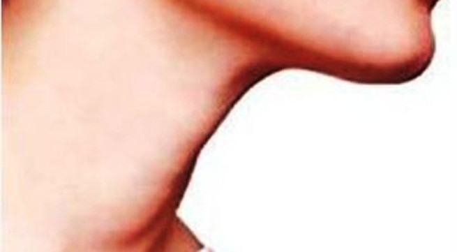 Vì sao yết hầu sưng đau khi trời lạnh? Ảnh minh họa: Internet