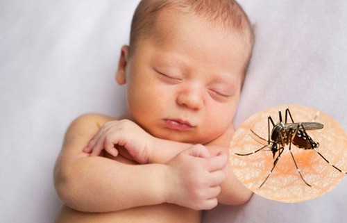 Trẻ sơ sinh nhiễm virus Zika có bị hội chứng đầu nhỏ không? Ảnh minh hoạ: Internet