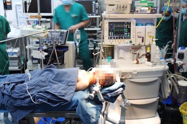 Ca mổ giá 12 tỷ đồng cho 2 trẻ động kinh kháng thuốc 2 bệnh nhi được phẫu thuật hoàn toàn miễn phí bằng kỹ thuật tiên tiến.