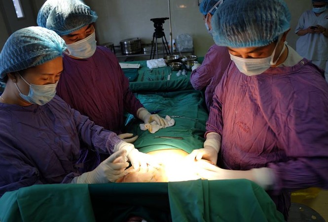 'Gọt' thành công tuyến vú cho nữ bệnh nhân có vòng 1 khủng Các BS đang phẫu thuật cho bệnh nhân có vòng 1 khủng lồ