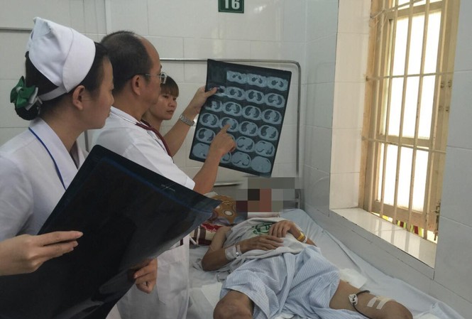 Phát hiện bệnh nhân mắc bệnh truyền nhiễm cực kỳ nguy hiểm PGS.TS Đỗ Duy Cường thăm khám cho bệnh nhân whitmore. Ảnh: BV Bạch Mai cung cấp