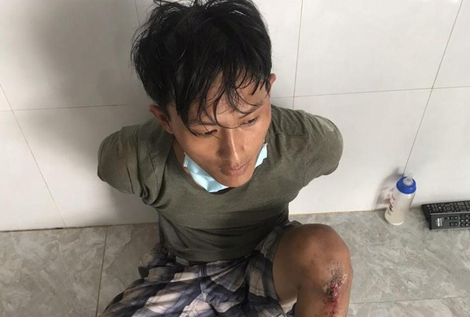 Đôi vợ chồng bị nhóm cướp đâm gục trên đường Trương Tấn Tài tại công an.