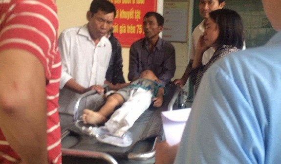 Cột điện đè nát chân bé 5 tuổi Cháu Sang đang được cấp cứu tại Bệnh viện Nhi Nghệ An