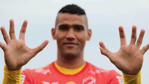 Thủ môn Brazil sở hữu bàn tay lạ kỳ có... 6 ngón Thủ môn Brazil sở hữu bàn tay lạ kỳ có... 6 ngón