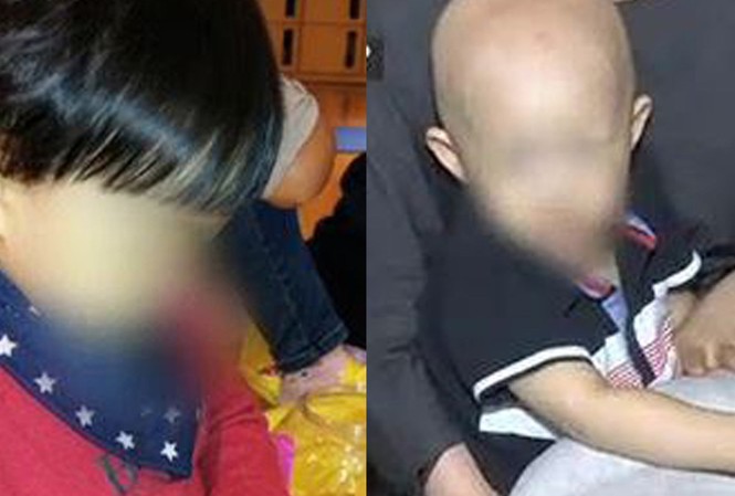 Bé 2 tuổi đầu trọc lốc vì uống thảo dược để ngủ ngon Từ một cậu bé có mái tóc đen dày, giờ bé Chang đã thành trọc đầu chỉ sau 1 tuần uống thảo dược.