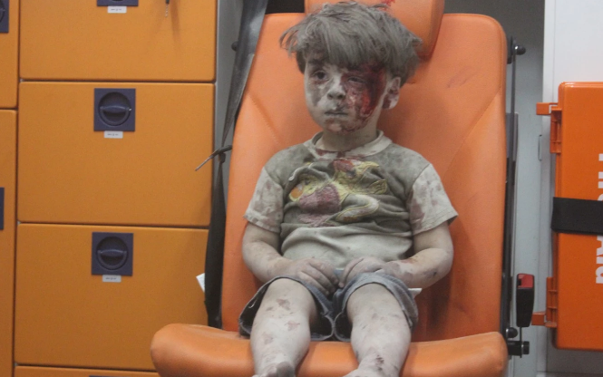 Hình ảnh em bé Syria người đầy máu khiến thế giới dậy sóng Em bé dính đầy máu và bụi đang là biểu tượng cho sự khốc liệt của cuộc chiến ở Syria.