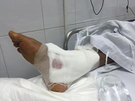 Vụ mổ nhầm chân ở BV Việt Đức: Bác sỹ thừa nhận không đọc bệnh án? Vụ mổ nhầm chân ở BV Việt Đức: Bác sỹ thừa nhận không đọc bệnh án?