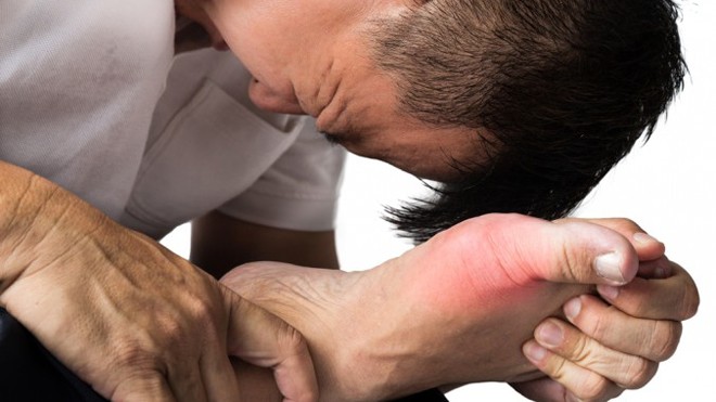 Cảnh báo: Số người bị bệnh gút đang 'leo thang' trên thế giới Số lượng người mắc gút đang ngày càng gia tăng