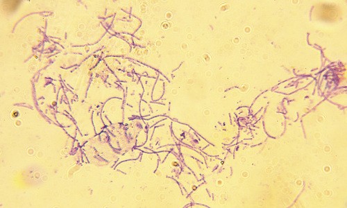 Hiểm họa từ bệnh than trong chiến tranh sinh học Vi khuẩn bệnh than có hình que dài. Ảnh: Live Science.