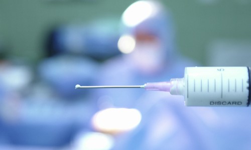 Vì sao thuốc tê có thể khiến bệnh nhân bị ngộ độc khi phẫu thuật? Gây tê cũng có rủi ro nhất định. Ảnh minh họa: Cloudfront.