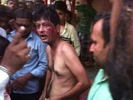 Bị cắt phăng 'của quý' vì cố hiếp dâm cô gái Bị cắt phăng 'của quý' vì cố hiếp dâm cô gái