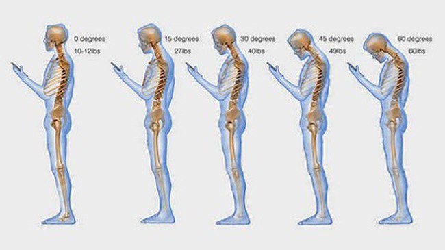 Sử dụng smartphone nhiều có thể ảnh hưởng xấu đến cột sống Thường xuyên cúi đầu để sử dụng smartphone và các thiết bị di động sẽ tác động không tốt đến cột sống cổ.