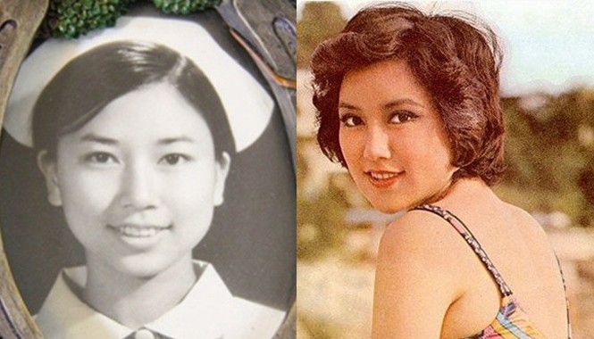 'Thảm họa thẩm mỹ' 65 tuổi tiếc nuối nhan sắc trời sinh Vẻ đẹp thời chưa dao kéo của "thảm họa thẩm mỹ".