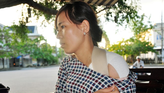 Đánh vợ, giành con, lấy xe máy sau ly hôn Chị Nguyễn Thị Hóa với vết thương mà chị tố là bị anh Tú đánh.