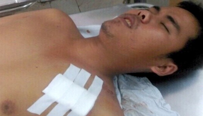 Một chiến sĩ CSCĐ bị đâm trọng thương khi làm nhiệm vụ Đồng chí Nguyễn Thương Hoài hiện đang được điều trị tại bệnh xá công an tỉnh Tiền Giang.